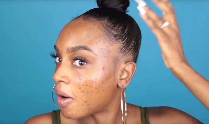 This Chemical Peel Video Has Almost 7 Million Views — See If You Can Look Away