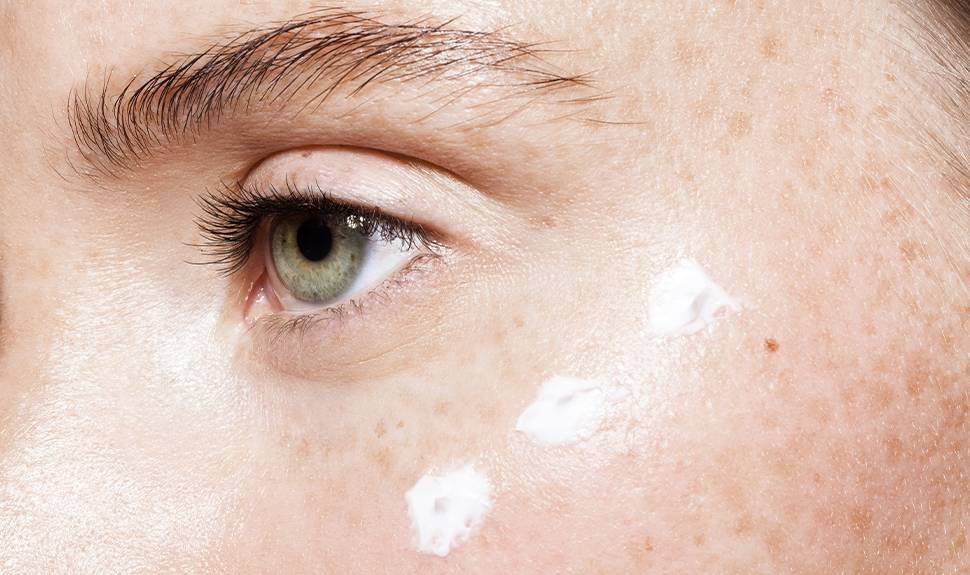 Derm DMs: Do I Really Need an Eye Cream?