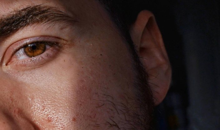 InMySkin: Skin-Care Influencer Cormac Finnegan Shares His Story