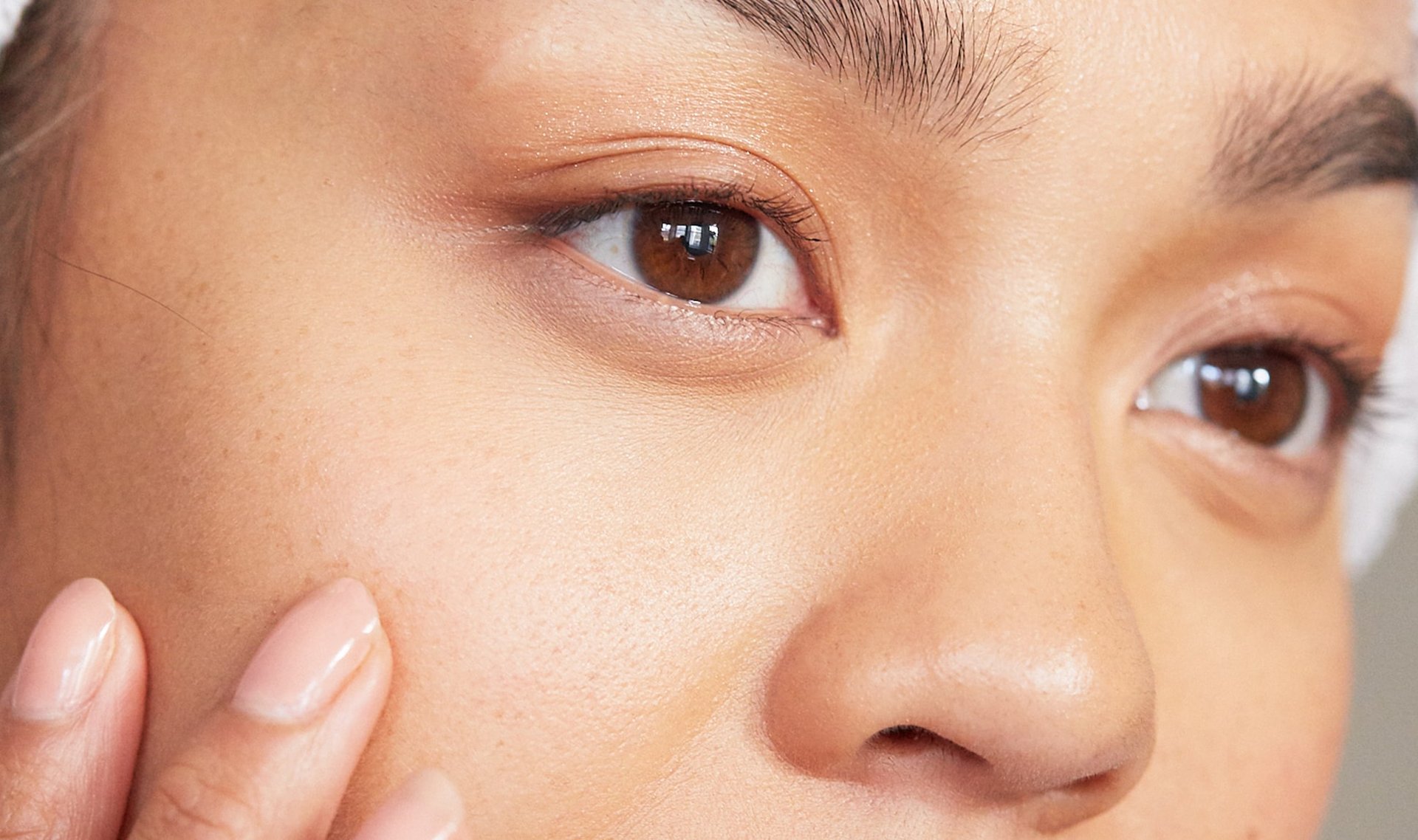 Will Aloe Vera Gel Clog Pores