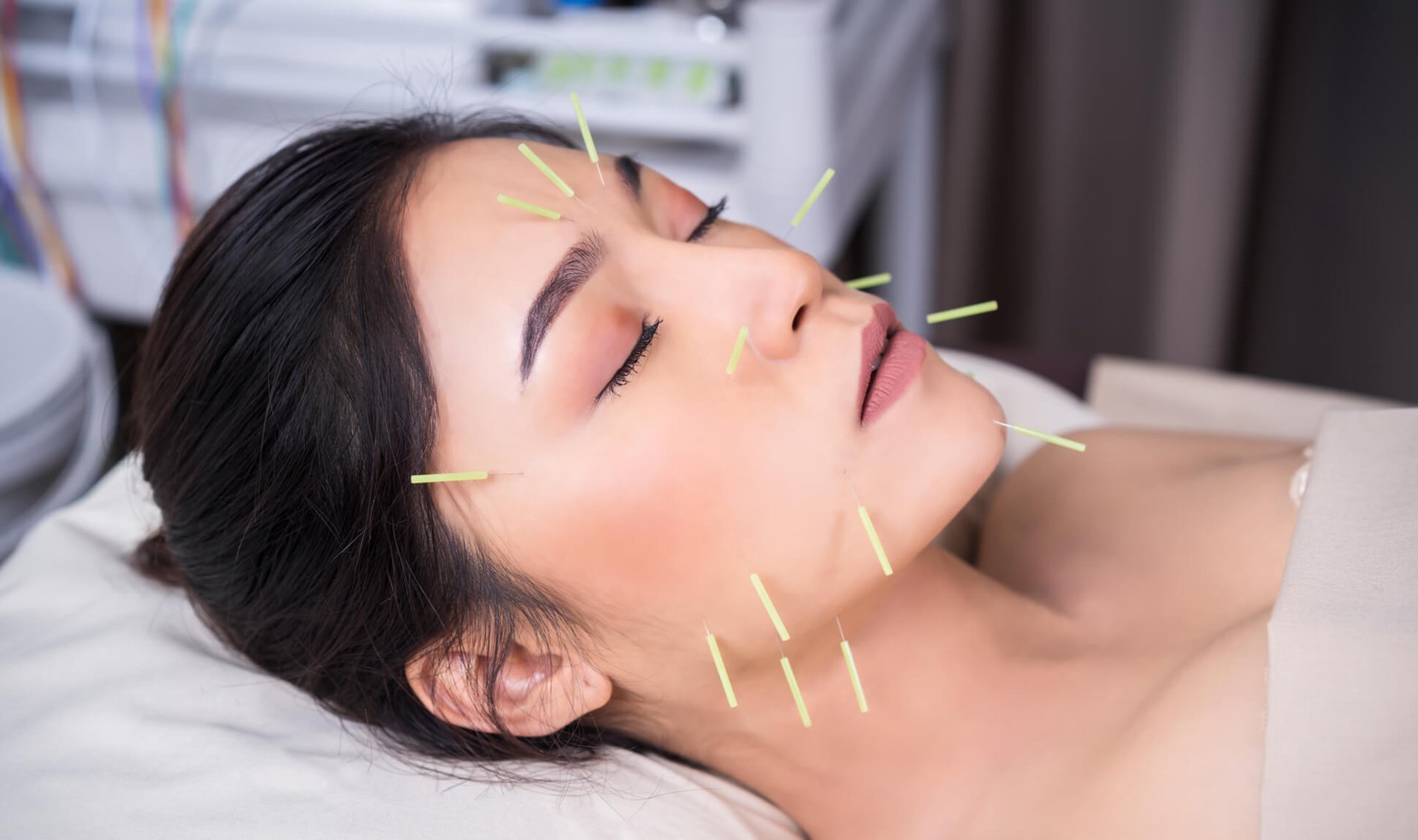 Skin Sleuth: Can Acupuncture Make Your Skin Better? 
