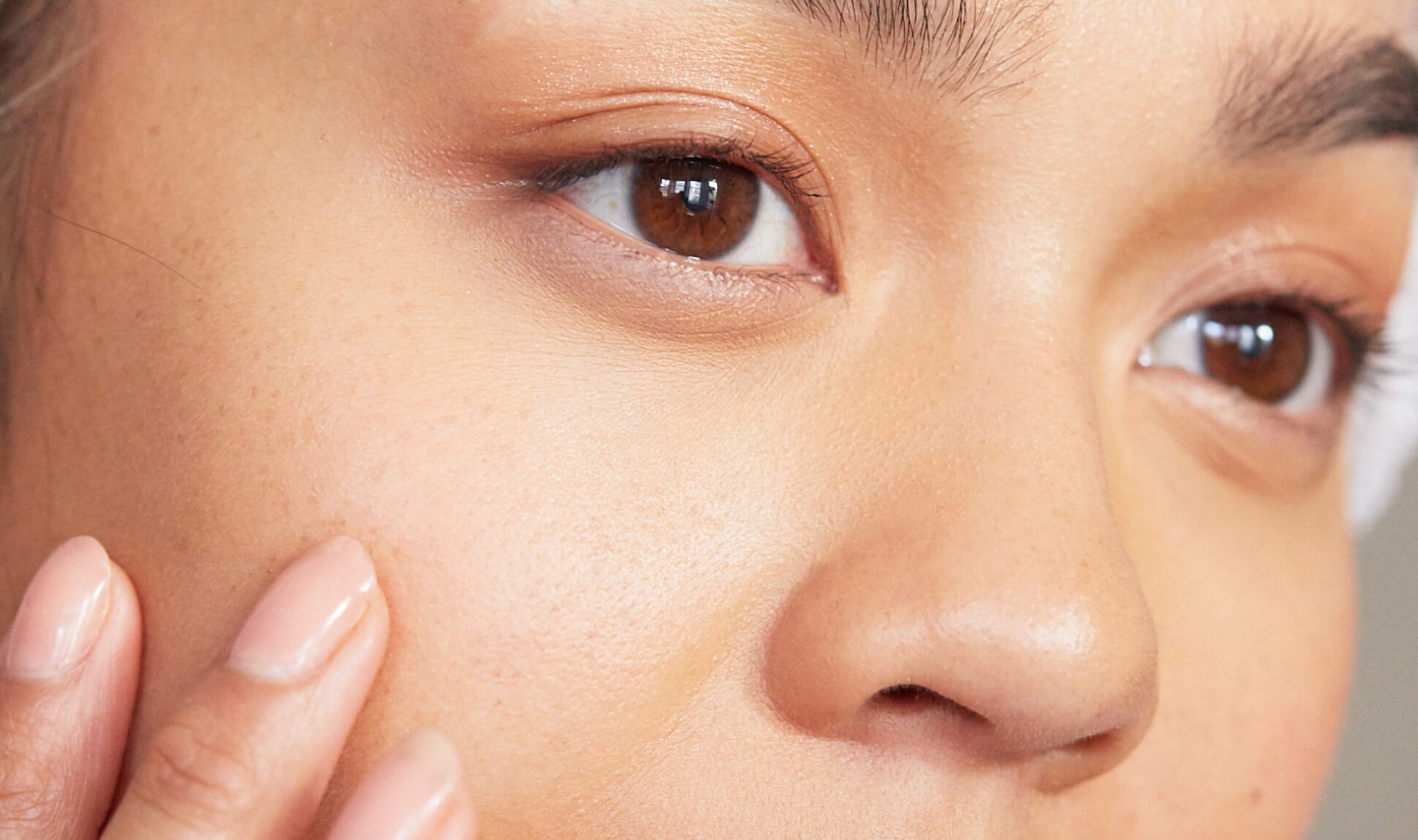 7 Potential Acne Causes Behind Those Out-of-Nowhere Breakouts