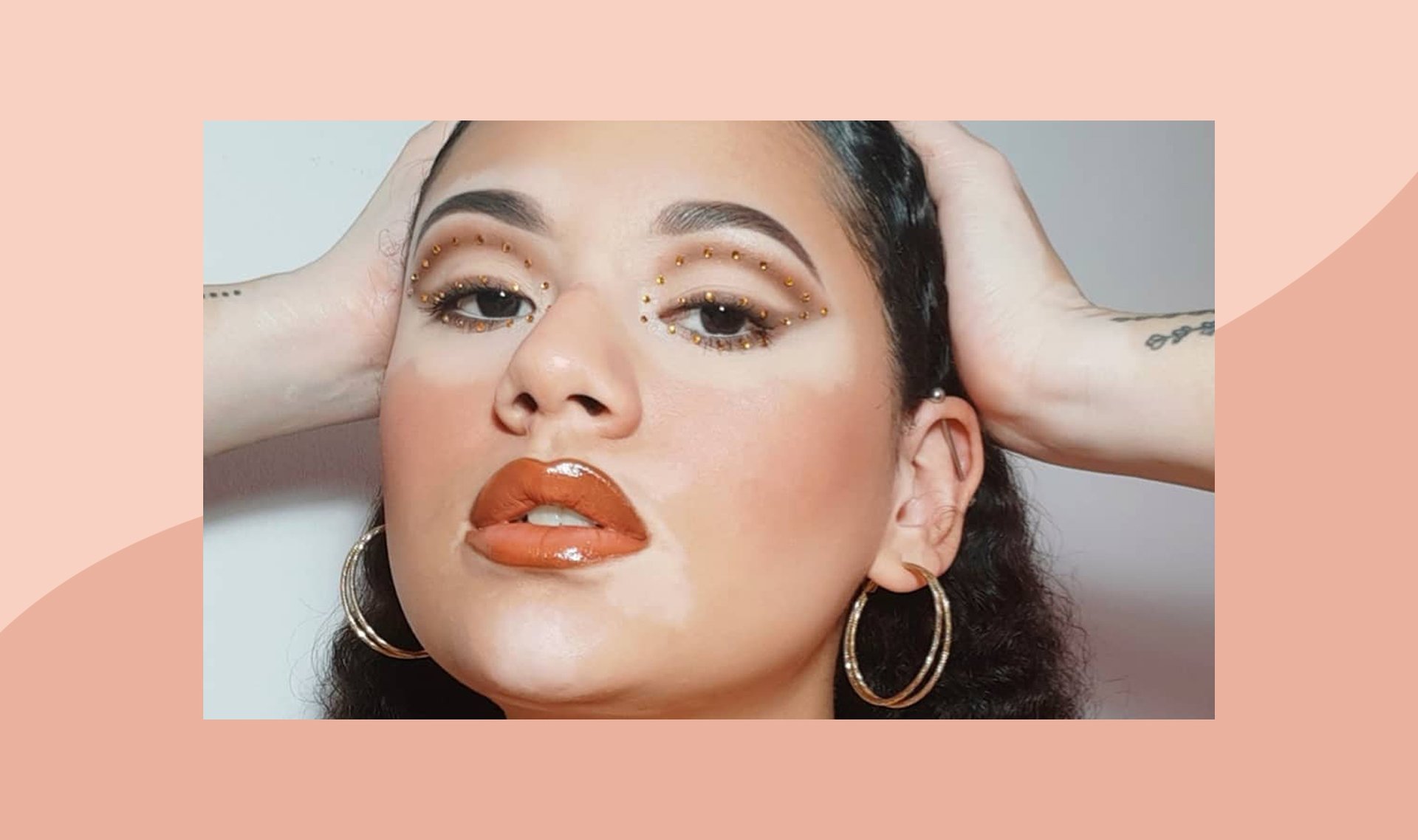 #InMySkin: How Gabi Romero Overcame Her Insecurity About Vitiligo