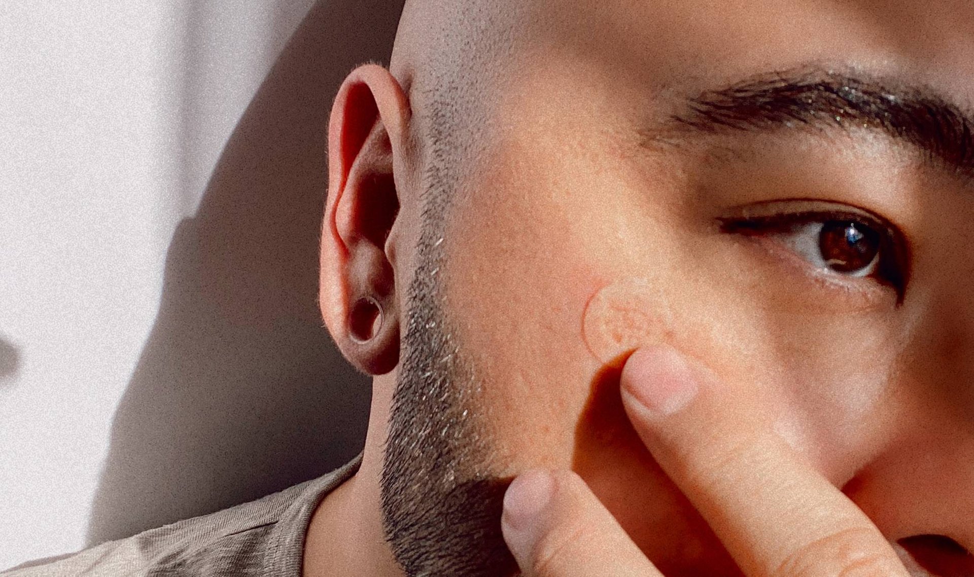 How To Make Pimples Less Noticeable | Skincare.com