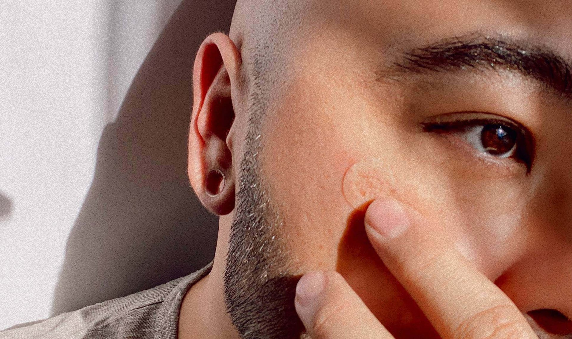 person wearing a pimple patch