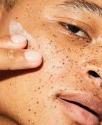 Closeup photo of a young man applying skincare product to his cheek with his fingers.