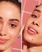 Person with freckles