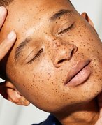 Person with freckles closing their eyes and holding their head with their hands