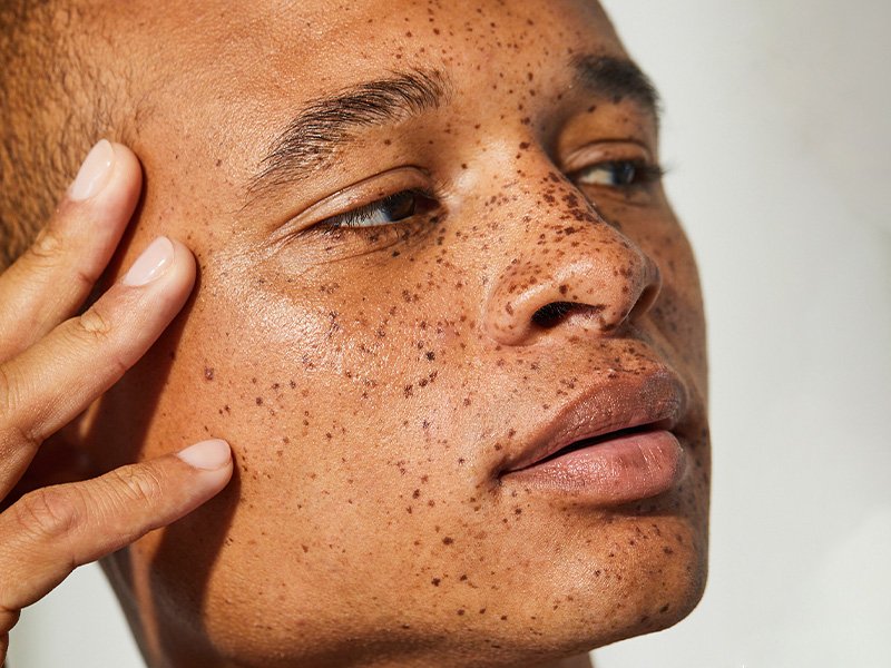 Person with freckles touching their fingertips to the right side of their face and looking to the side