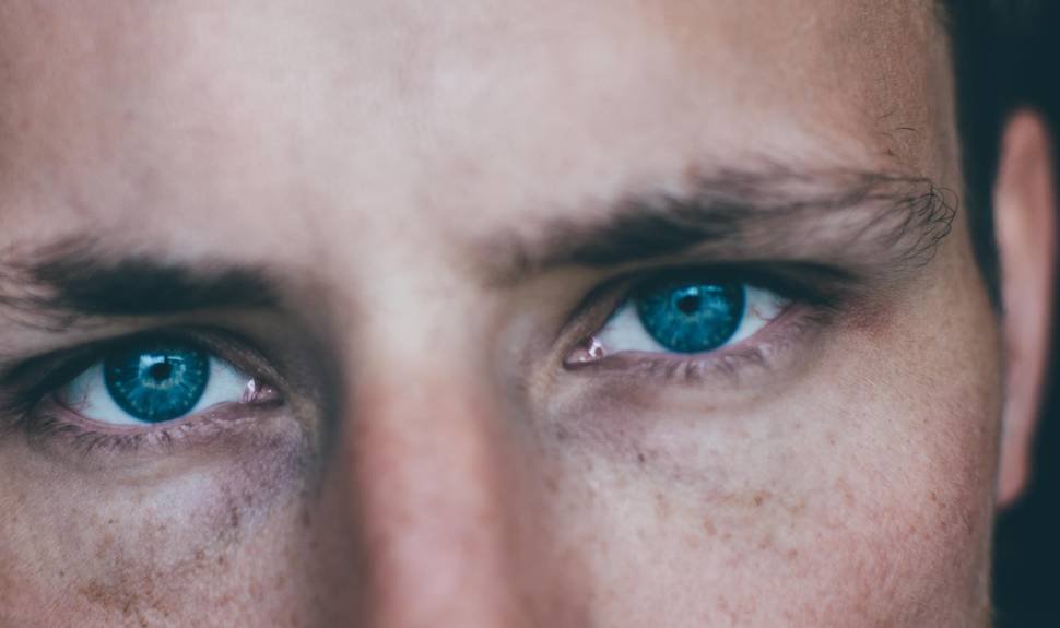 Mens dark shop circles under eyes
