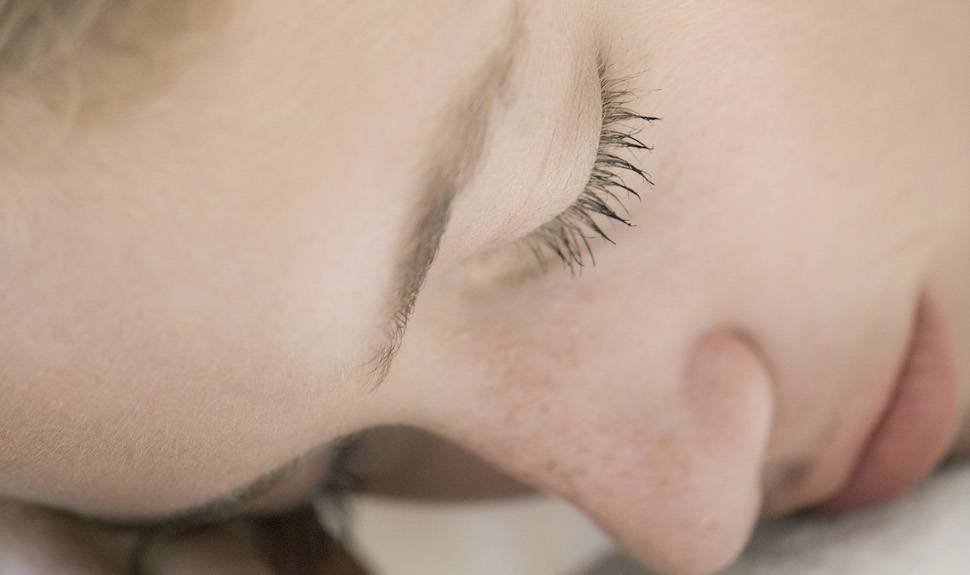 Ask the Expert: What Is a Glycolic Acid Peel?