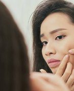 How to Safely Pop a Pimple, According to a Dermatologist