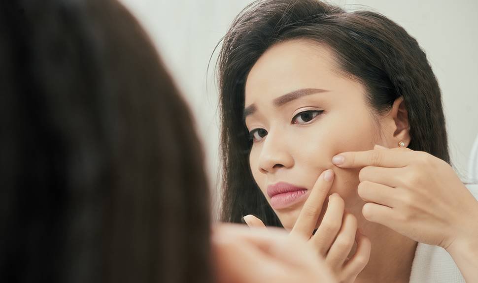 How to Safely Pop a Pimple, According to a Dermatologist