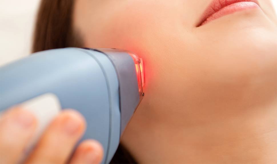 How Do Laser Treatments For Acne Actually Work?