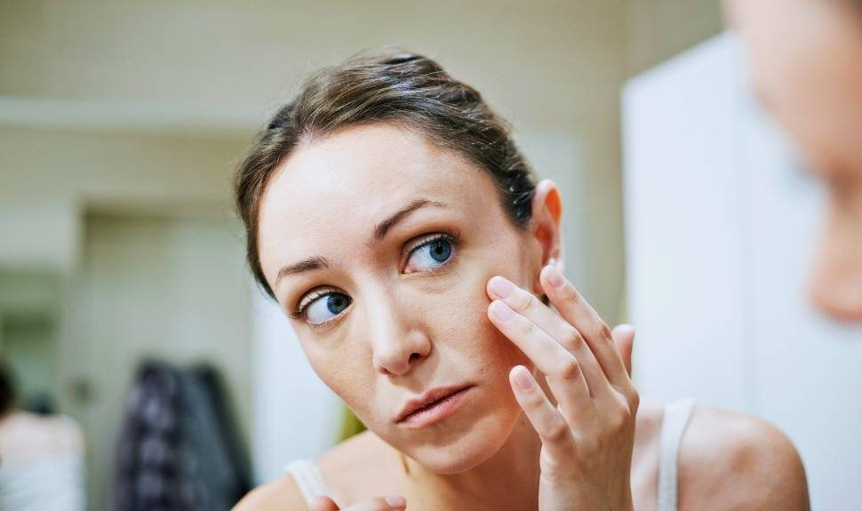 Hands Off: How to Stop Picking at Your Skin
