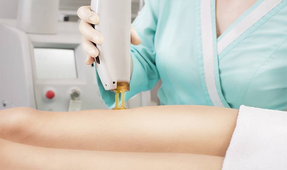 Ask the Expert: The Best Time to Start Laser Hair Removal Treatments