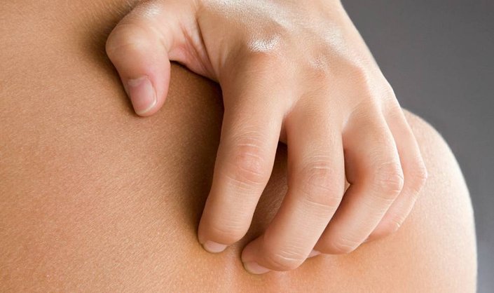 How to Ease an Itchy Bug Bite When You Don't Have Calamine Lotion