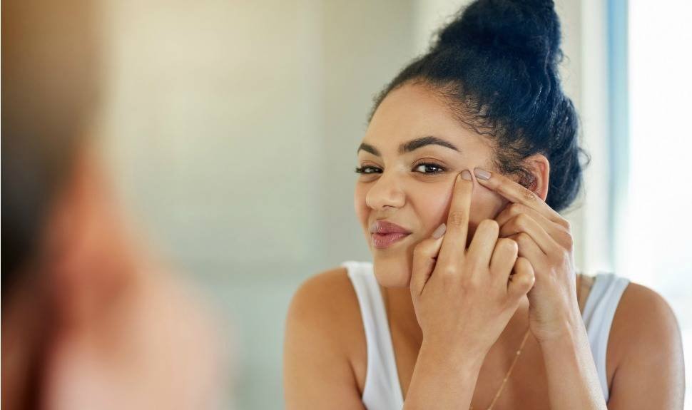 8 Things you should never do if you have acne