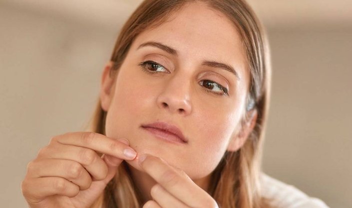 How to Cover Up a Pimple Fast