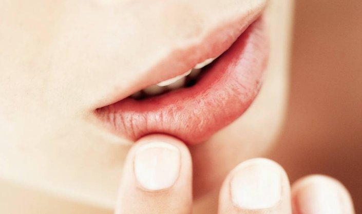 A Nourishing Lip Balm to Give Dry Lips the Boot
