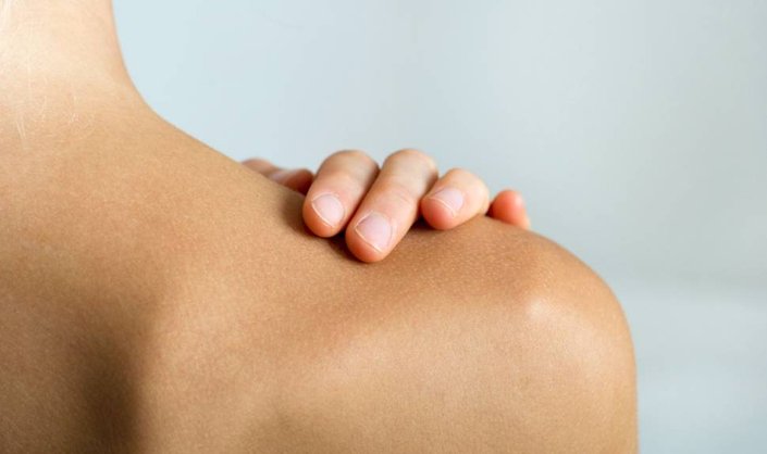 Back Acne 101