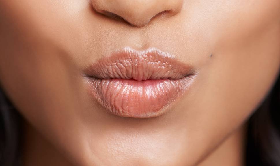 How to Keep Chapped Lips Away: 5 Tips to Perfect Your Pout