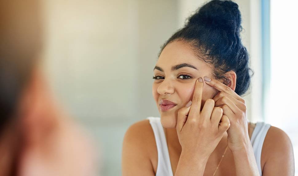 Breaking Out? Here Are 8 Things You Should Not Do